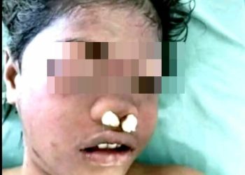 Jasad Tanpa Identitas Ditemukan, Nur Mintana Hasibuan Diduga Korban Pembunuhan