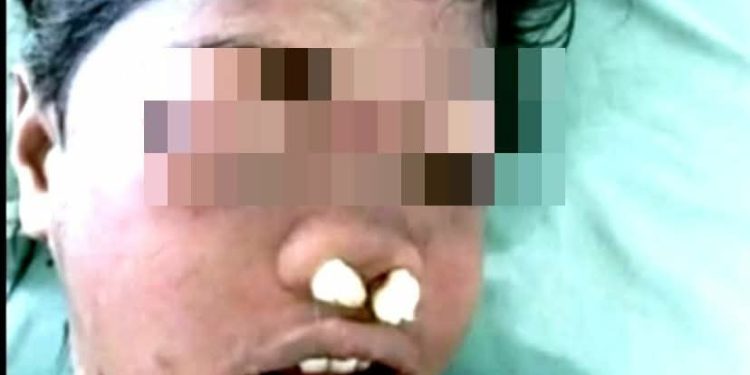 Jasad Tanpa Identitas Ditemukan, Nur Mintana Hasibuan Diduga Korban Pembunuhan