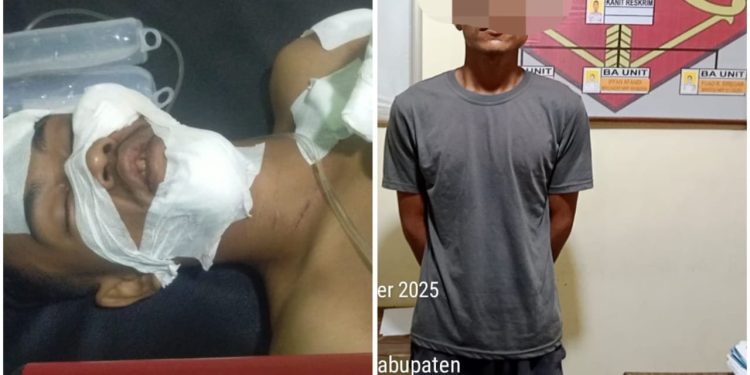 Motif Cinta Seorang Pemuda Dibacok Saat Tidur Di Aceh Singkil